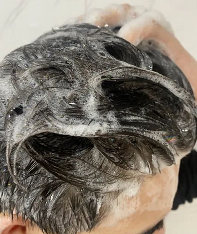 大块大块地掉头皮屑,有什么好用的男士去屑洗发水推荐?