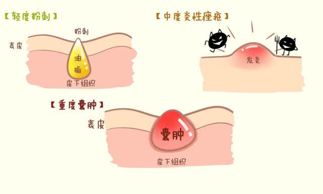 v2-d8689625b5dbe13a1731a7ec241f25f3_1440w.jpg?source=172ae18b