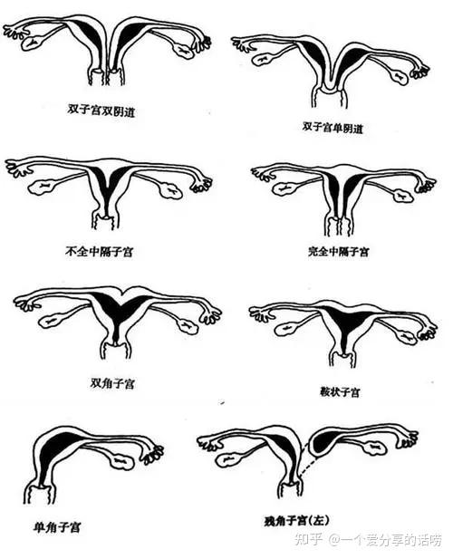 双子宫位置图片图片