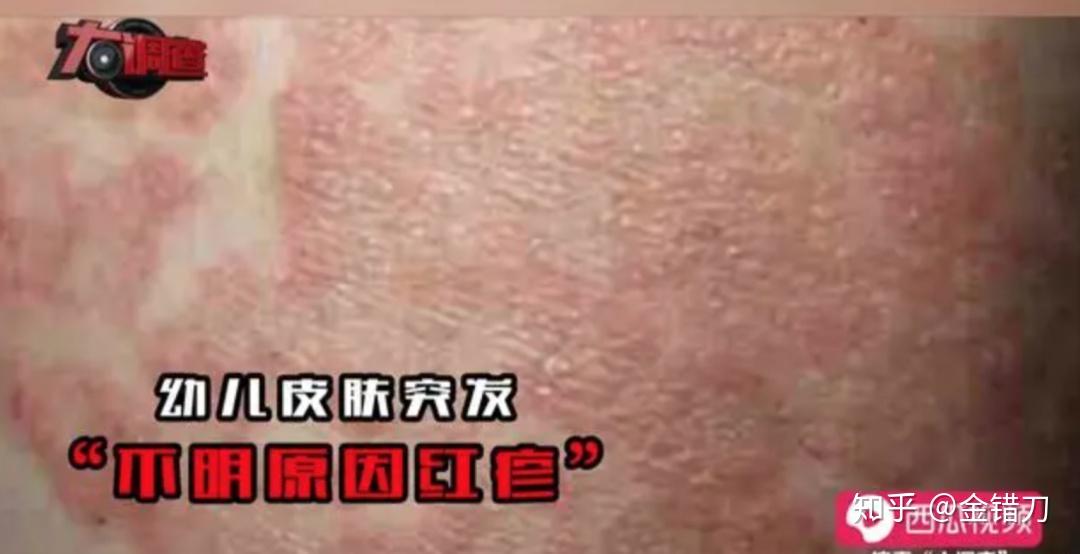 央视曝光，全民震怒！三鹿过后12年，奶粉杀手又卷土重来 - 知乎