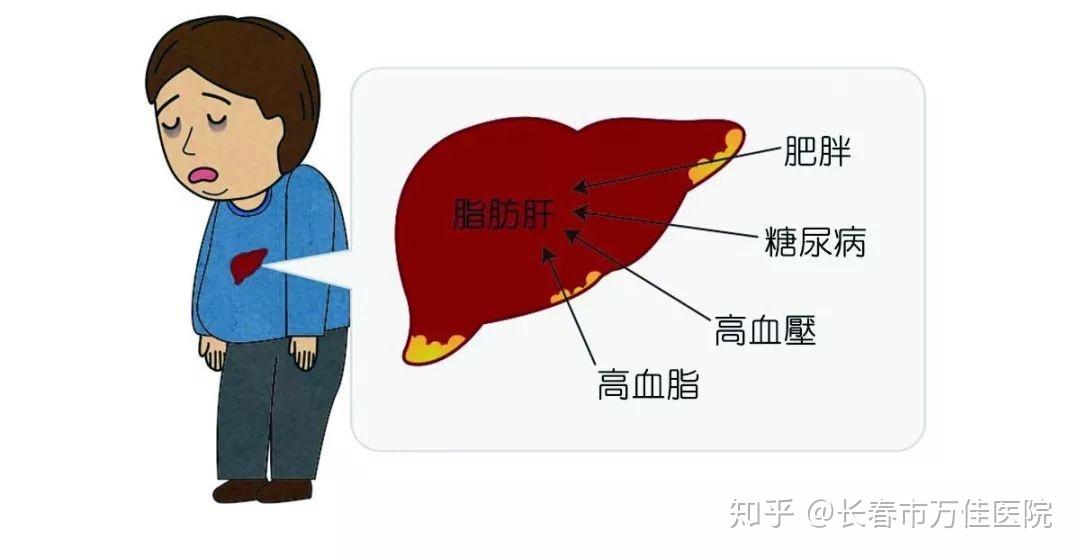 脂肪肝并非胖人专属瘦人也会得脂肪肝