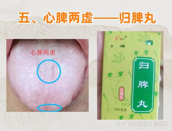 史上最全8种健脾祛湿中成药！学会全家受益 - 知乎