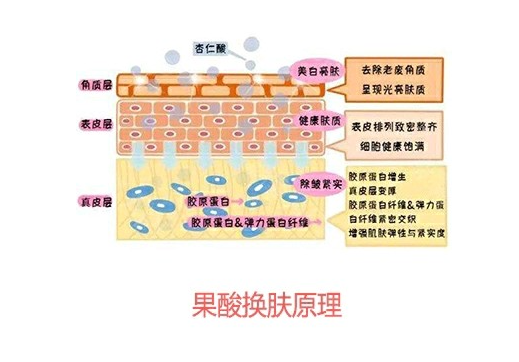 什么是刷酸刷酸爆痘如何解决