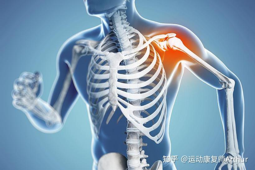 一文读懂带你了解肩周炎