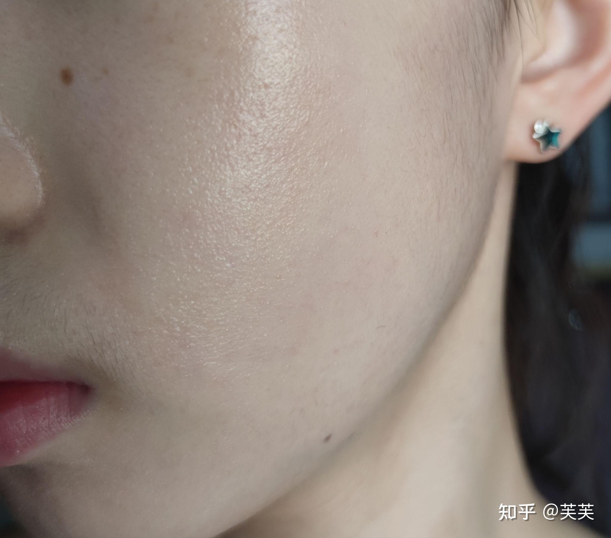 对抗逆光疹记录63286328