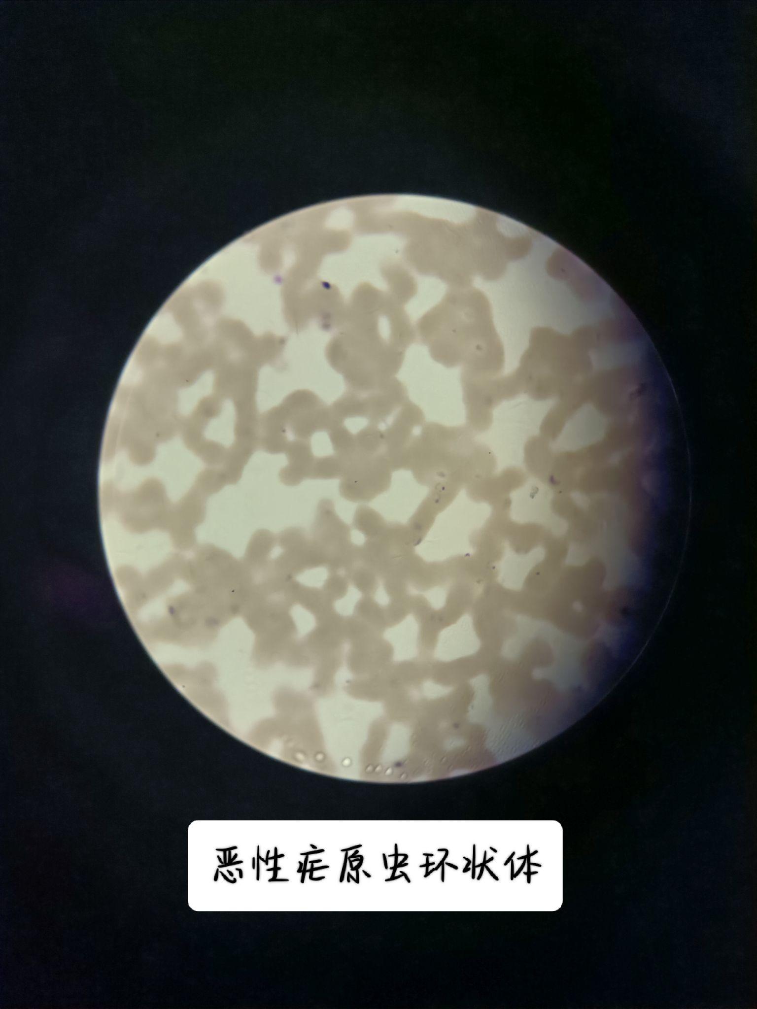 人体寄生虫实验标本 知乎 
