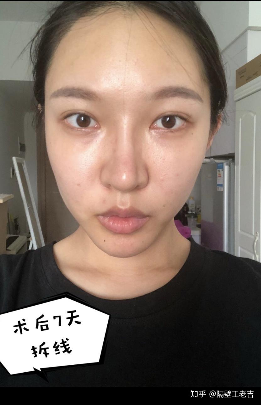 整形美容医院行业新趋势：技术与服务并驾齐驱