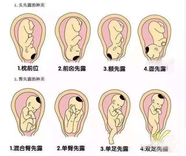 6个月胎心位置示意图图片