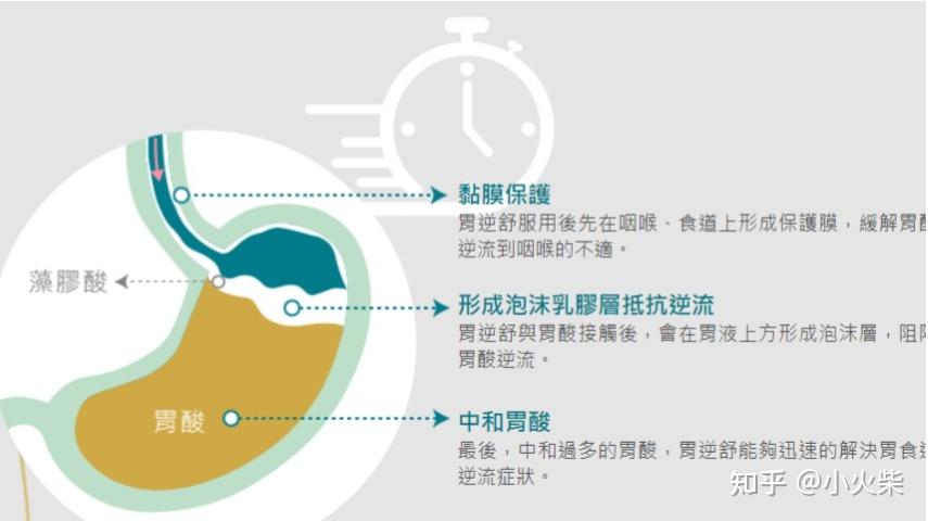 胃食管反流病治疗指南（国家消化系临床研究中心发布） - 知乎