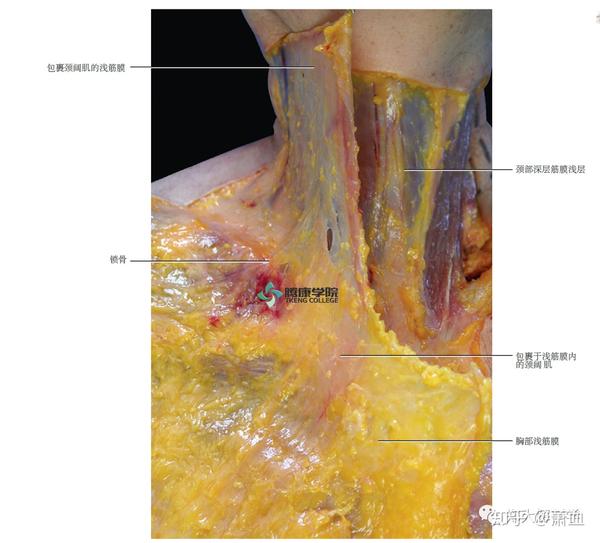 淺筋膜內的頸闊肌