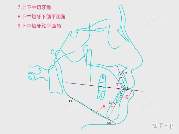 2.1 facial angle 面角(npog-fh)2.