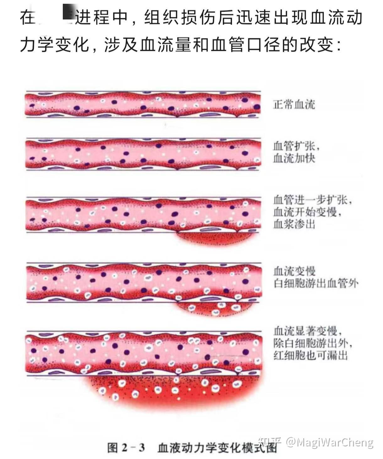 痘印不管会慢慢恢复吗? - 知乎