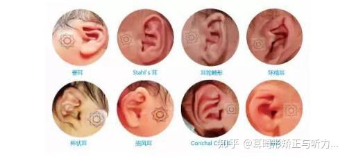 是什么原因引起耳朵听不见 v2-da7c4de6b2fa744c25f473092941ac21_r.jpg