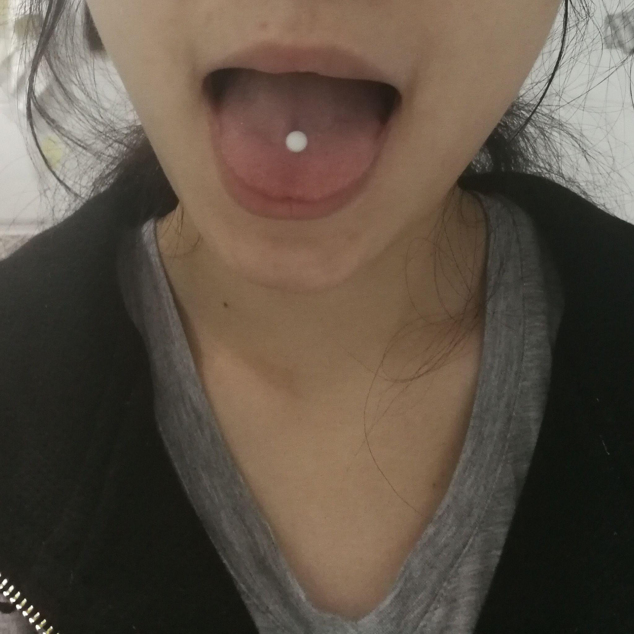 伟德国际打舌钉的利弊有哪些