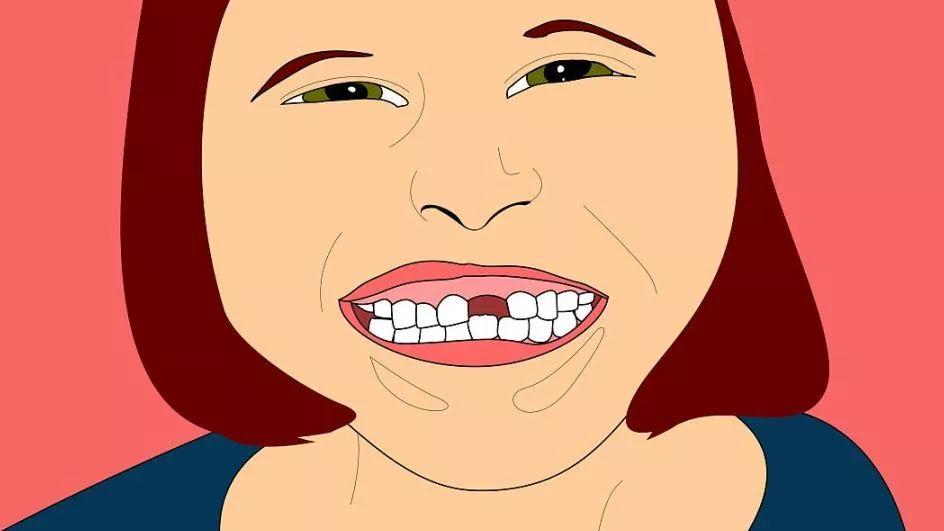 牙齿缺失的危害