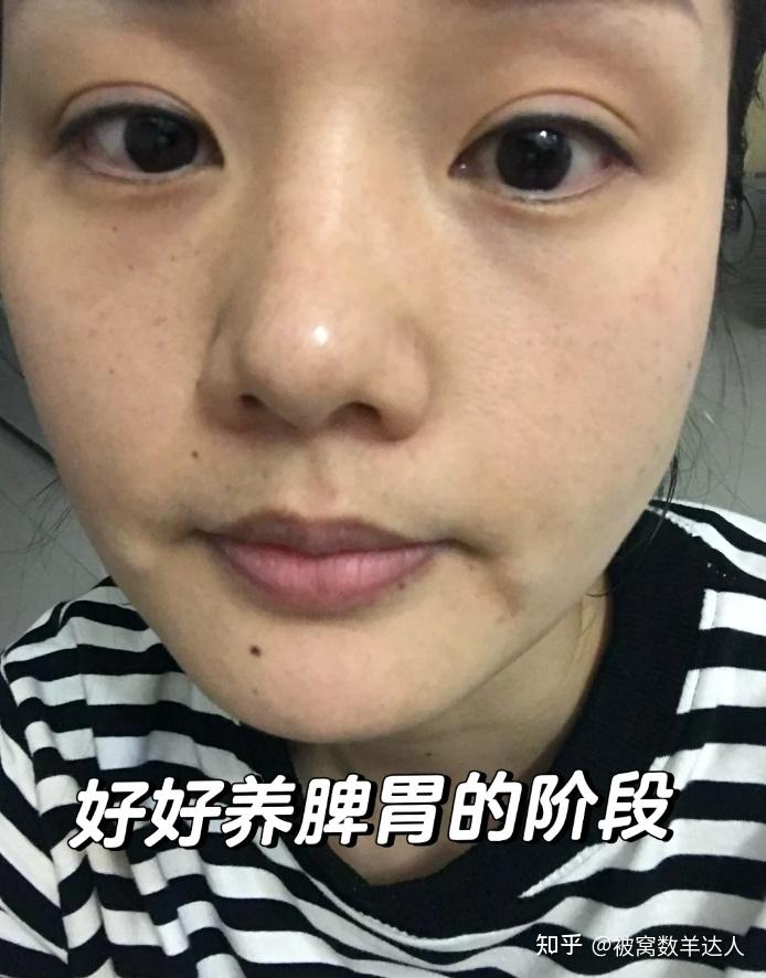 女生身体虚弱,如何预防气血不足啊?