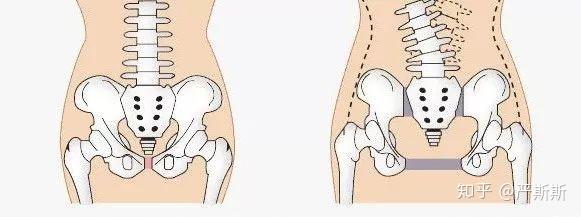 塌,还会造成各种产后妇科病,反反复复治不好,甚至容易引起耻骨错位