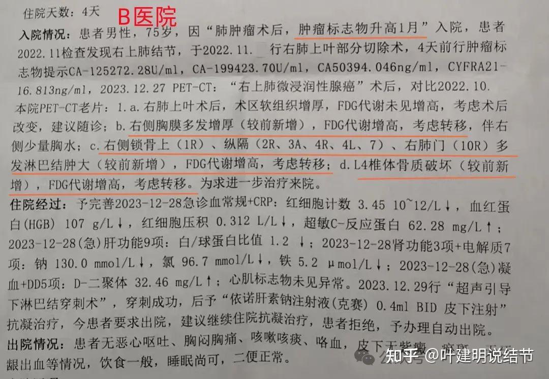 罕见病例剖析微浸润性腺癌术后1年广泛转移