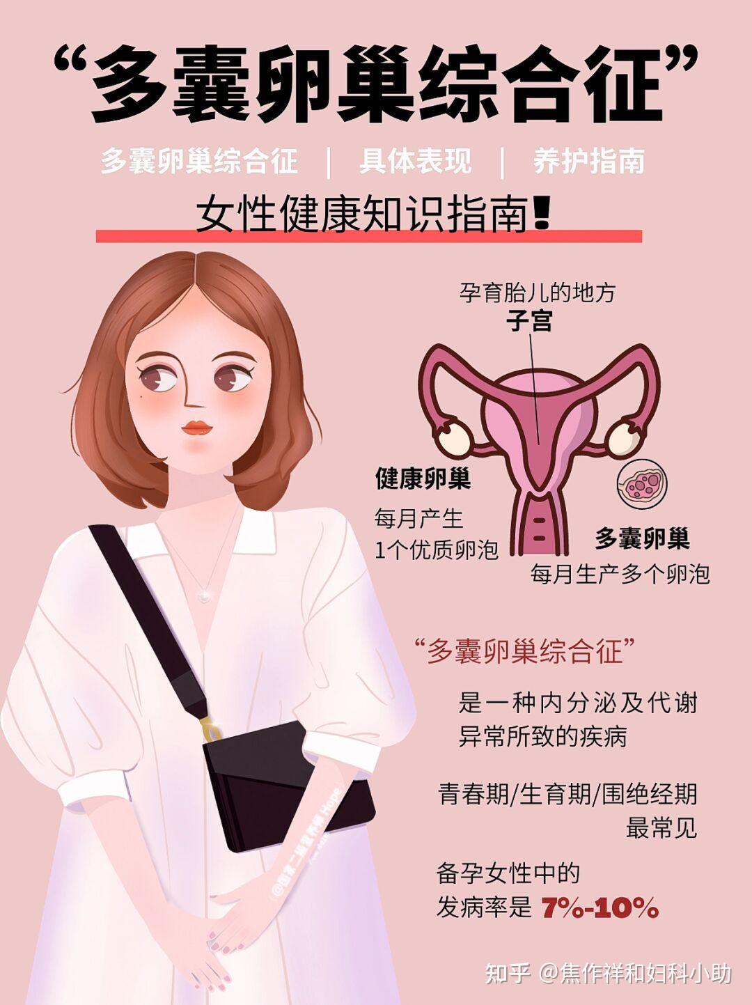 女性健康知识!多囊卵巢养护指南 - 知乎