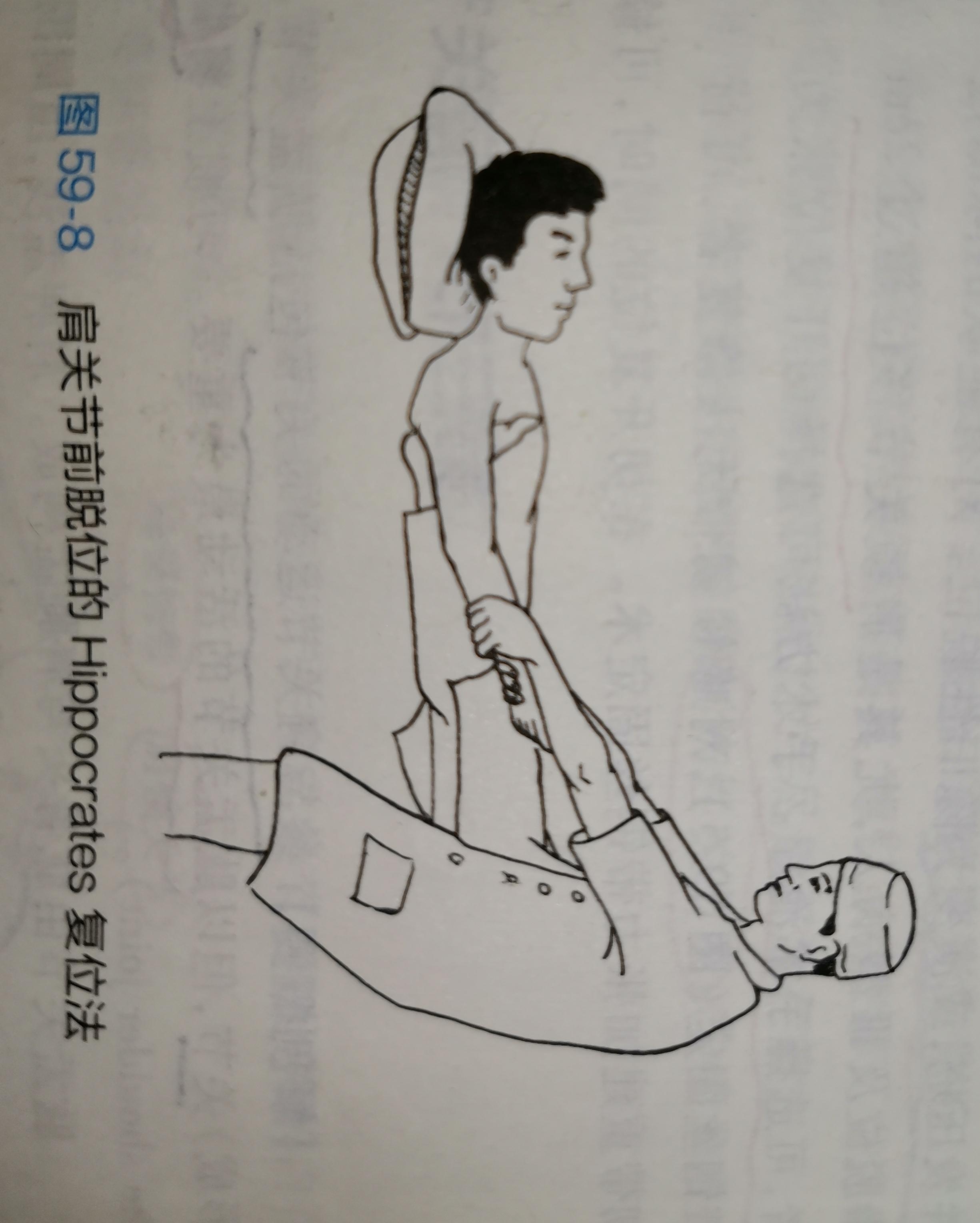 肩关节脱位足蹬法步骤图片