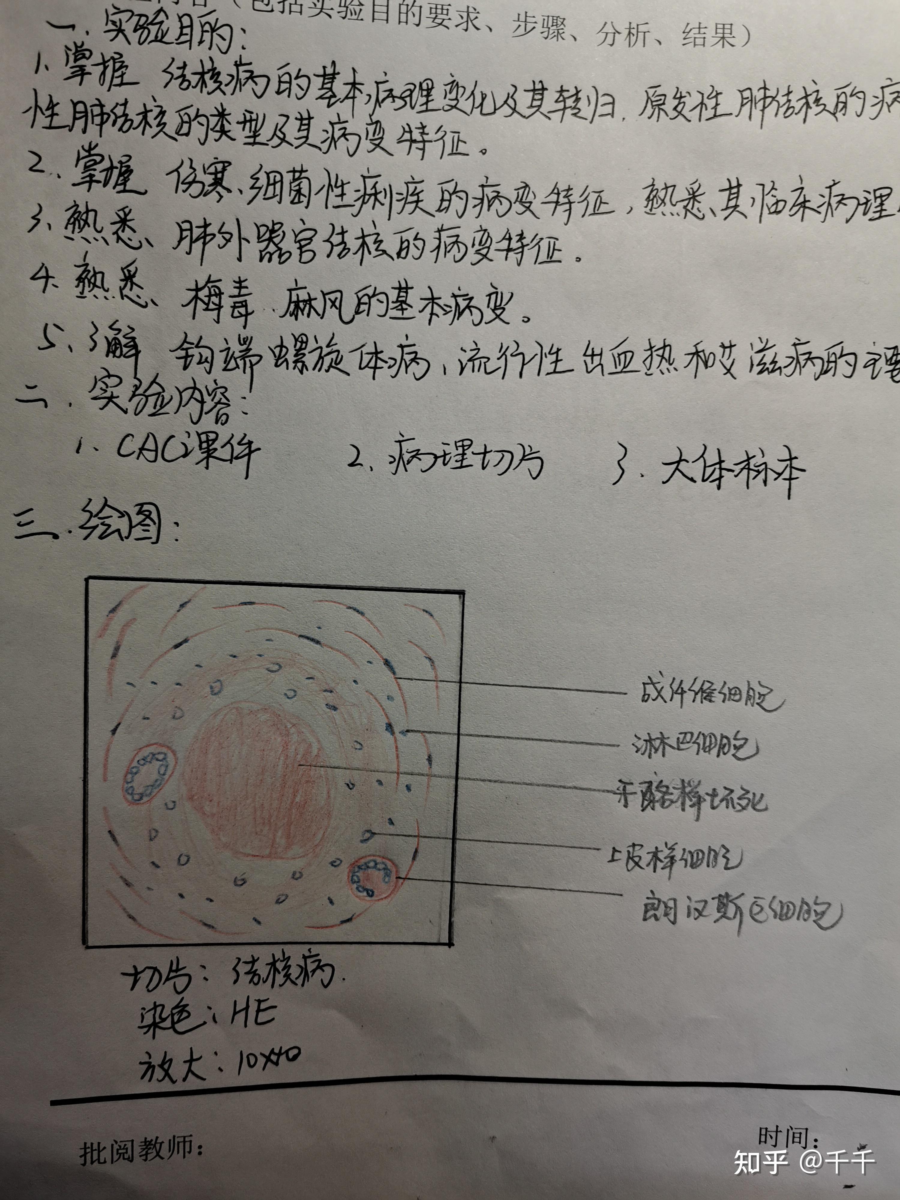 病理紅藍鉛筆繪圖