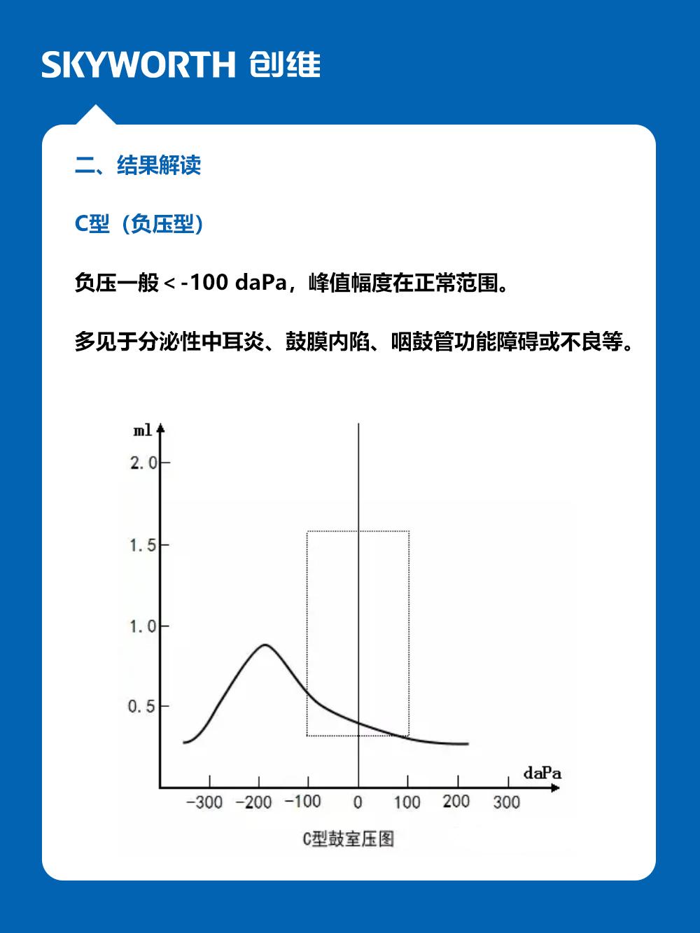 鼓室图分型及其意义图片