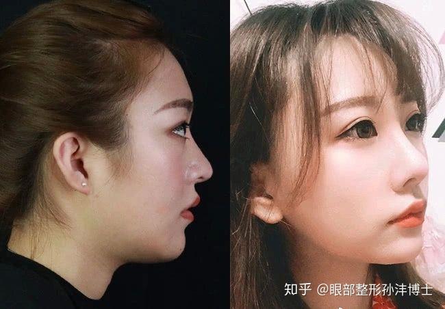 伊犁华美医疗美容区域医美服务布局特点解析