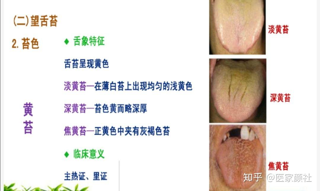 如何通过舌苔来判断身体健康与否?最全舌像来了,一分钟教你学会所有舌像! - 知乎