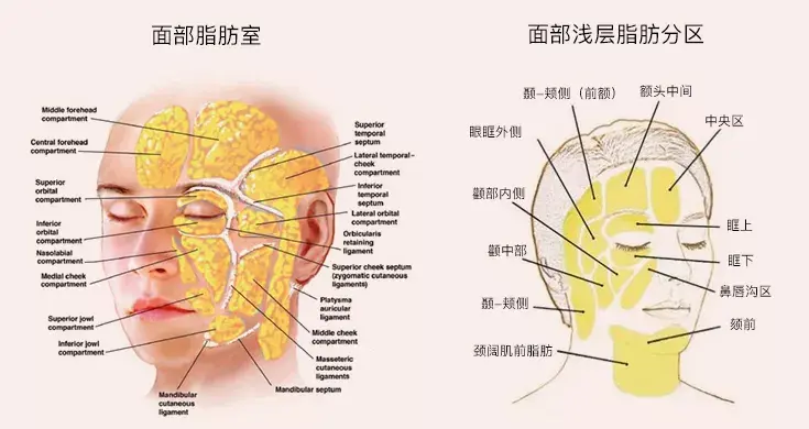 射频溶脂紧致黄金微雕是什么