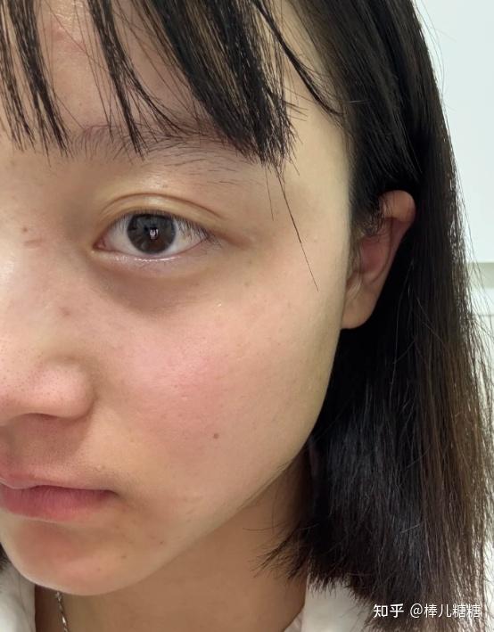 皮肤由白变黄是什么原因导致百科在线