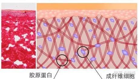 家用射頻美容儀能讓皮膚變緊緻嗎