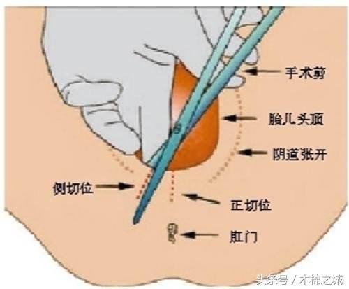 女人分娩顺产下面图片