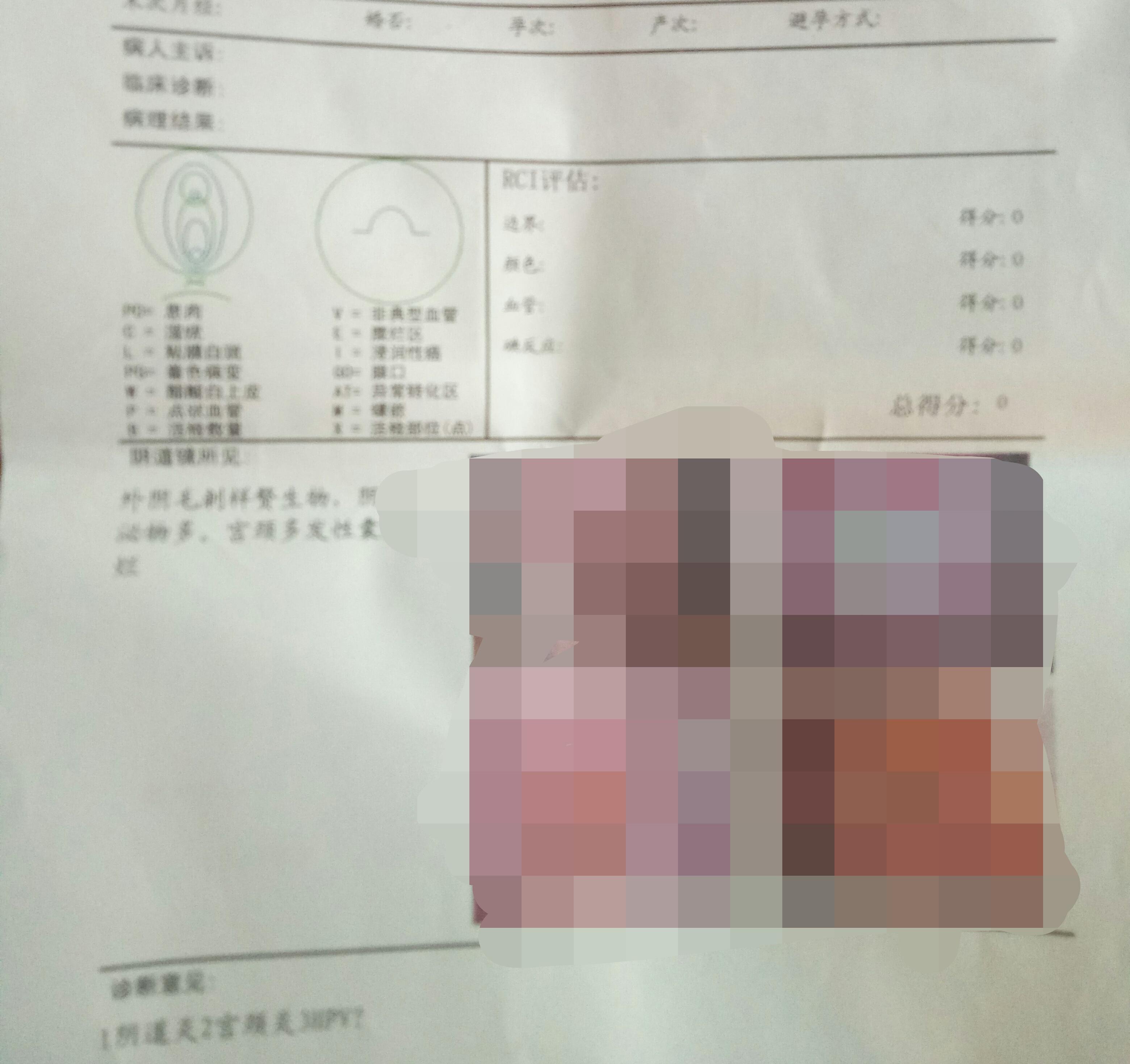 医院检查艾滋病要多久出报告 v2-dc803636bba65364b3ffb7b35fc10e1a_r.jpg