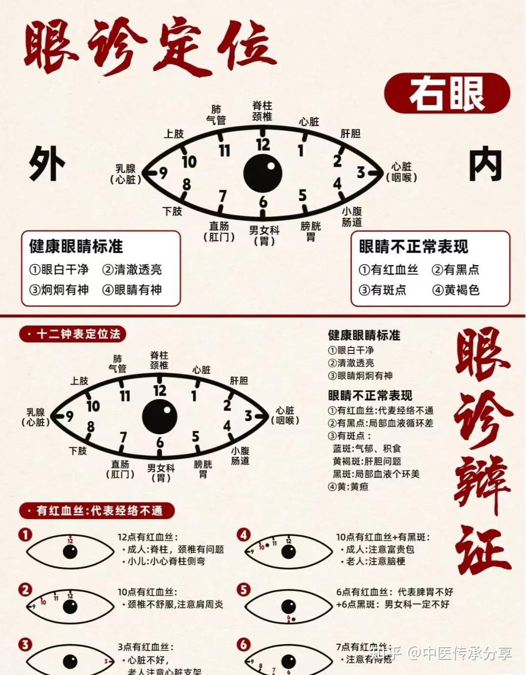 中医眼诊!(超全整理) - 知乎