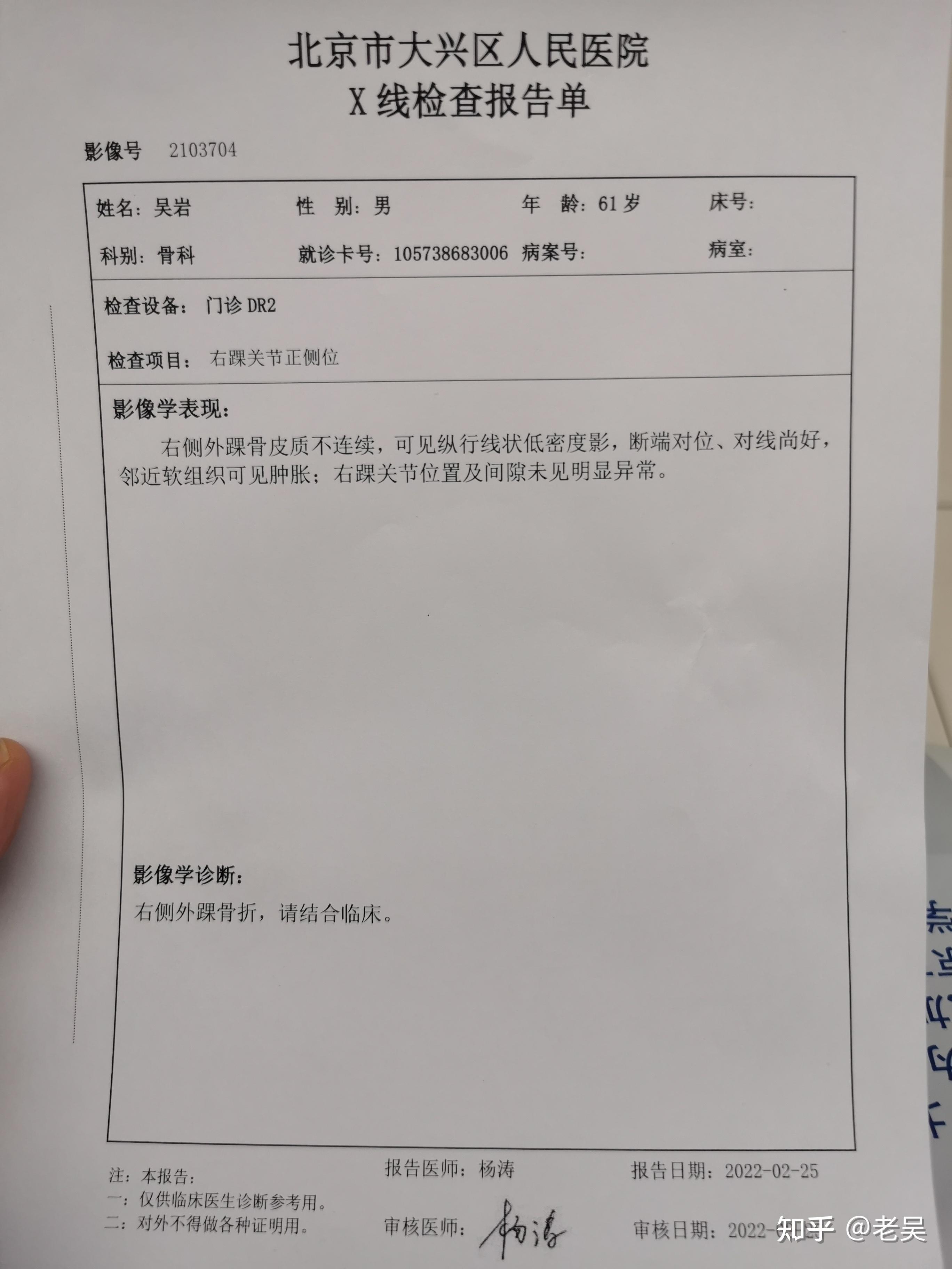 7人赞同了该文章 天有不测风云,由于自己不小心,导致了一次脚踝骨折