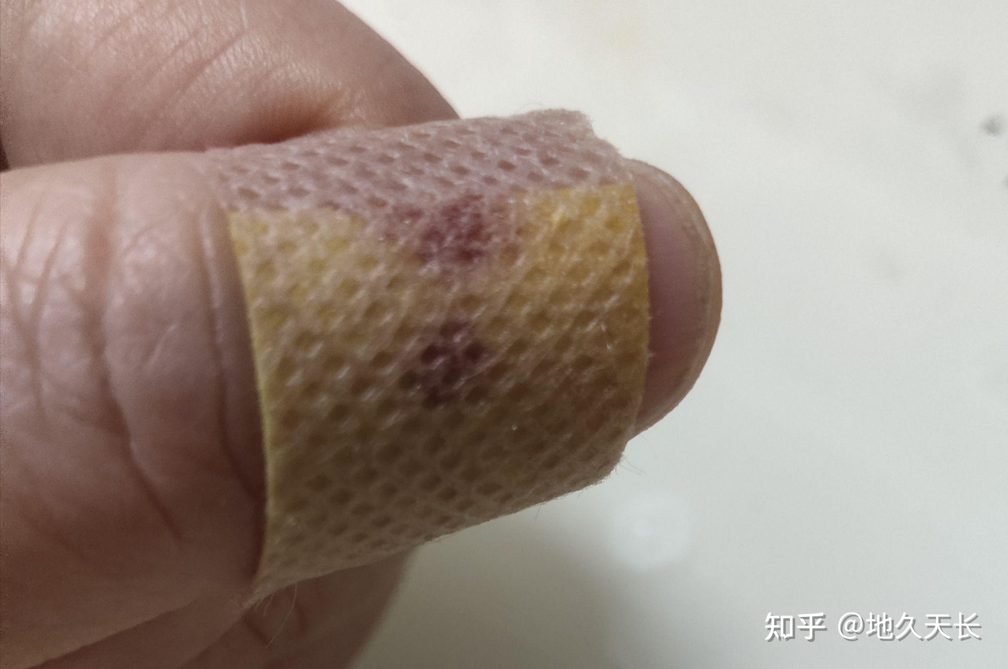 钝 刀 - 知乎