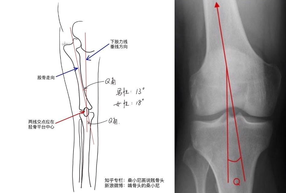 膝后夹角图片