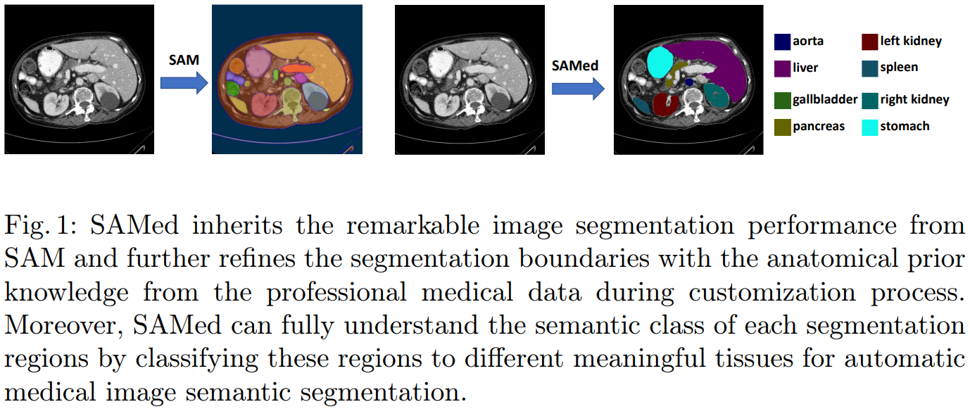  arxiv 2304 segment anything model samed 