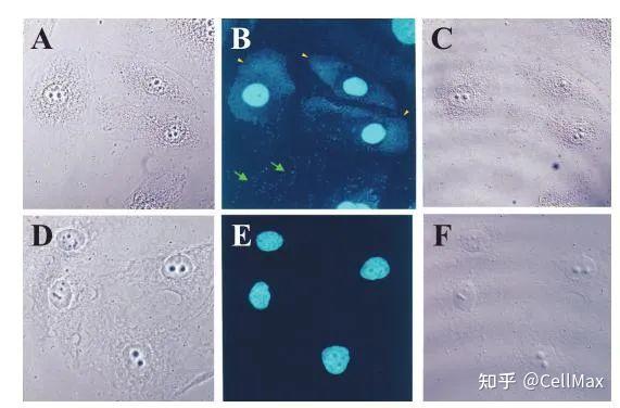 图3 卵巢癌67r细胞用bm cyclin抗生素处理前后dapi染色检测支原体dna.