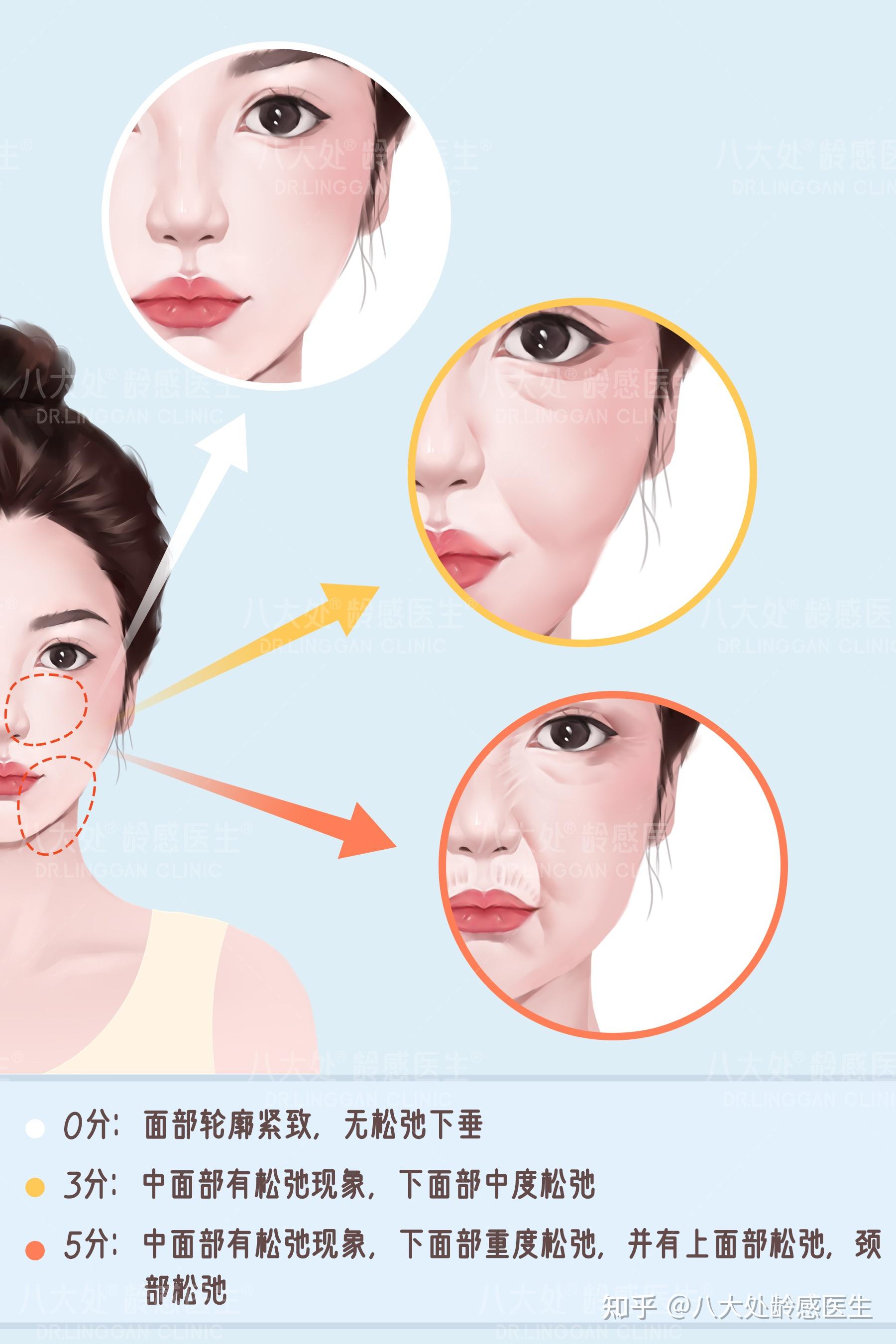 你的肌肤光老化到了哪个阶段？强烈建议每个人都来测一下！ - 知乎