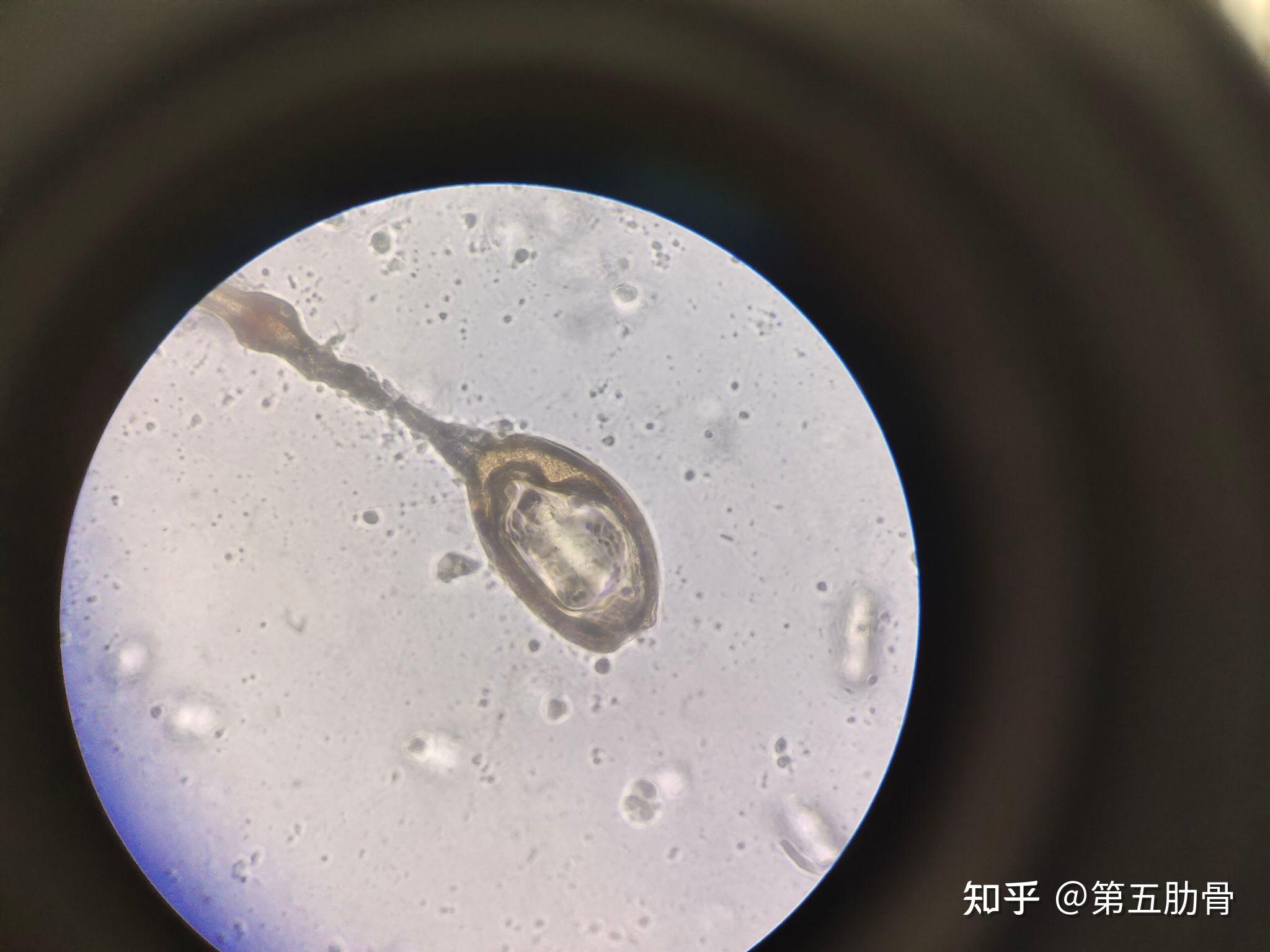 医学寄生虫学镜下实拍