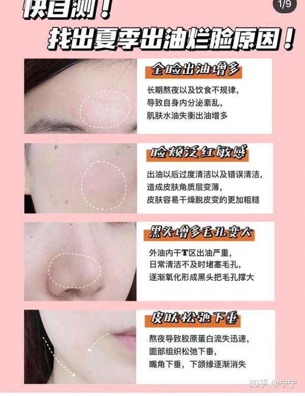 油皮该怎么护肤? - 知乎