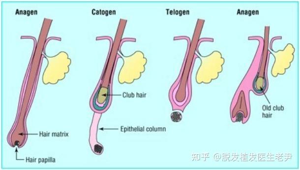 雄激素性脱发原理图片