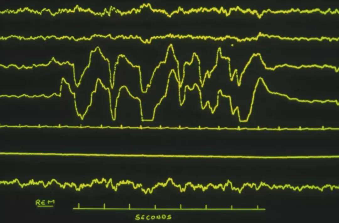 1&amp;amp;2为脑活动的脑电图(eeg);3是右眼运动的眼电图(eog);4