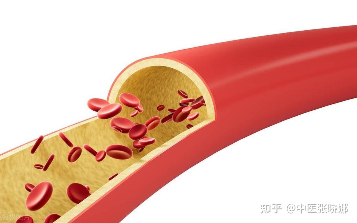 血脉不通,瘀血丛生,四个方子,驱逐各处瘀血,让你全身通畅轻松 - 知乎