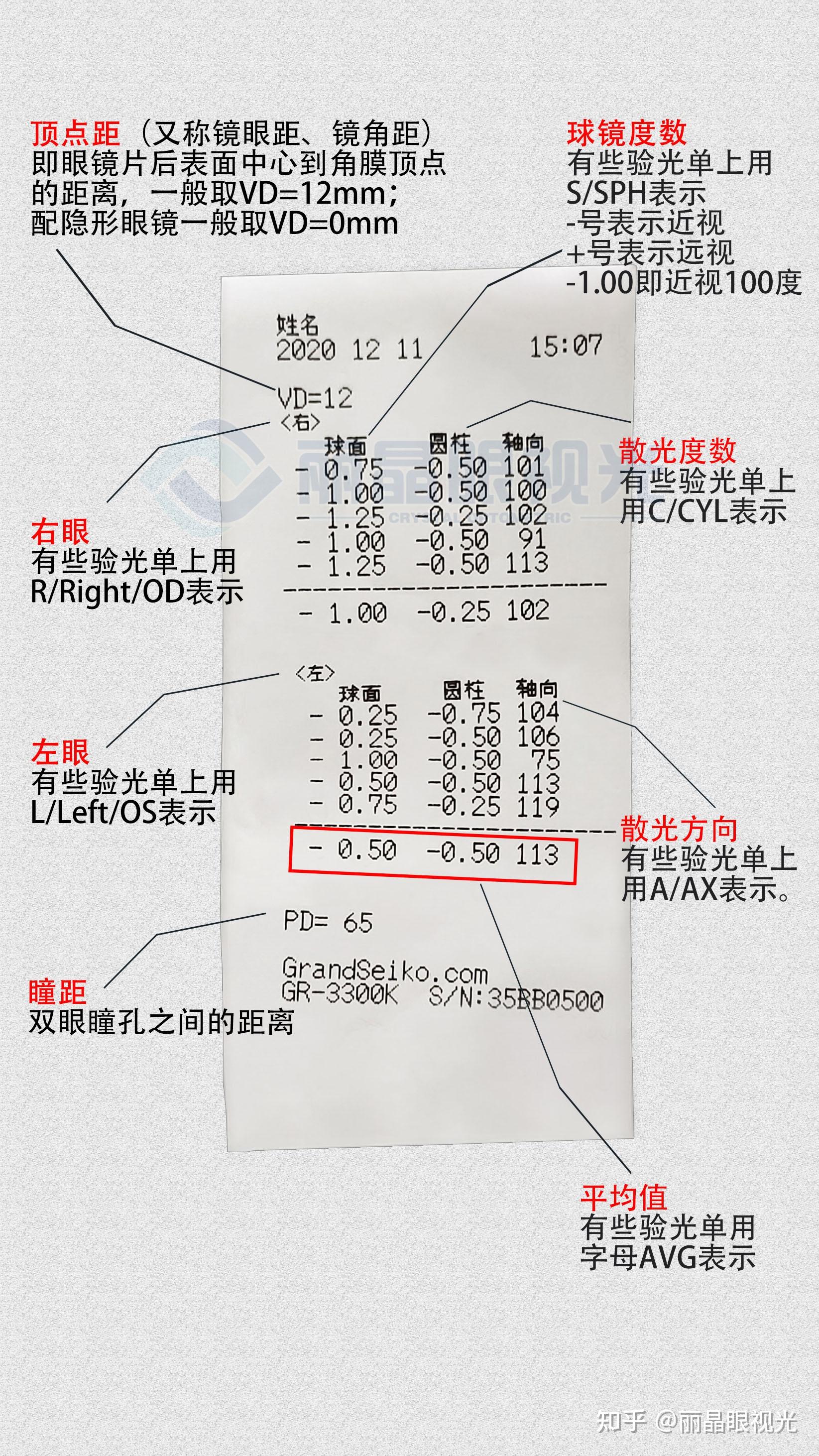 怎麼看醫院測眼睛度數的單子?