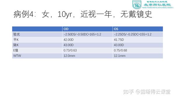 角膜地形图解读及露晰得塑形镜验配要点（文字版） - 知乎