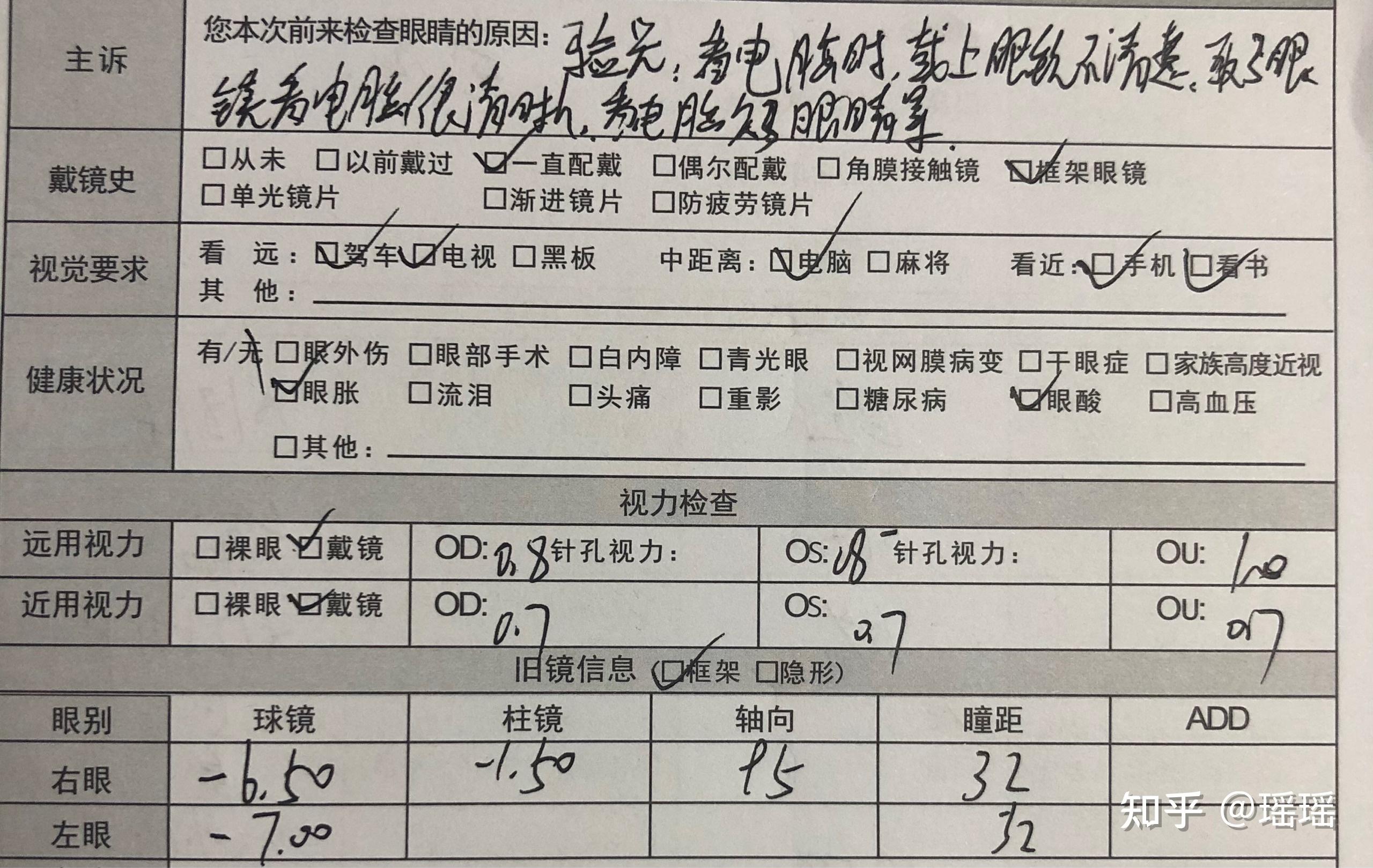 配镜只是单单验光就可以的吗