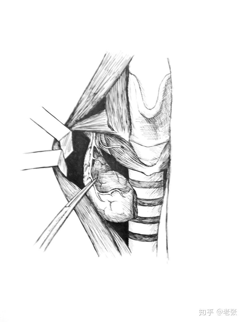 甲状腺手术前要做哪些检查
