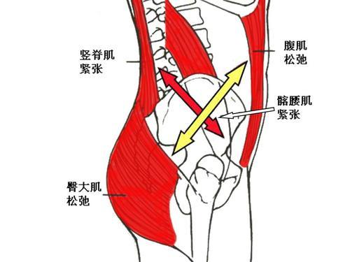 下交叉综合症